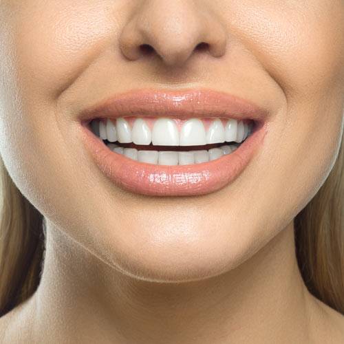 The Dental House - BONDING GAPS WITH COMPOSITE RESIN. IT IS USED TO CLOSE  SPACES BETWEEN TEETH.. Our dental practice offers high-end Cosmetic  Dentistry including Cosmetic Composite Tooth bonding. We pay close