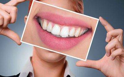 Understanding Dental Bonding: Its Procedure, Benefits, and Cost