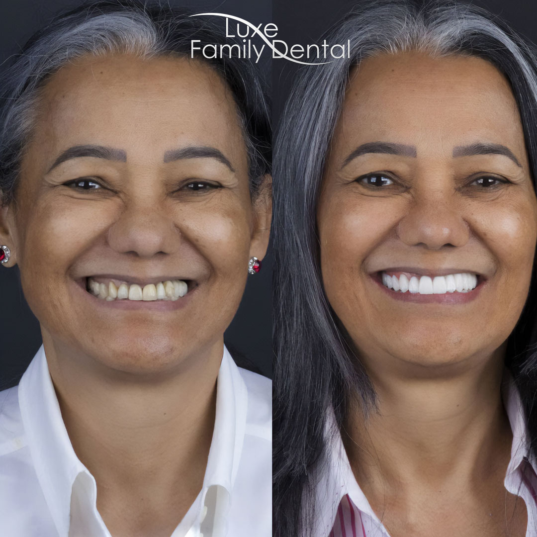 Dental Implants Specialist • Dentist in Lauderhill, Florida